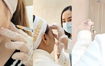 Botox injection wrinkle reduction treatment Skin House Clinic