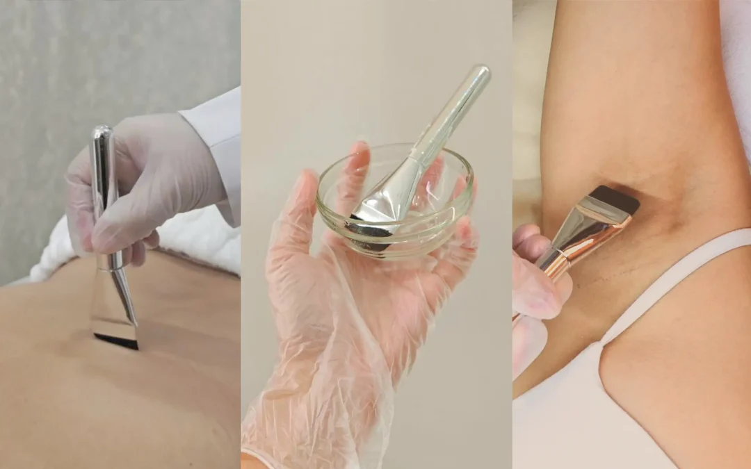 Chemical Peels for Dark Underarms: The Underrated Treatment That Delivers