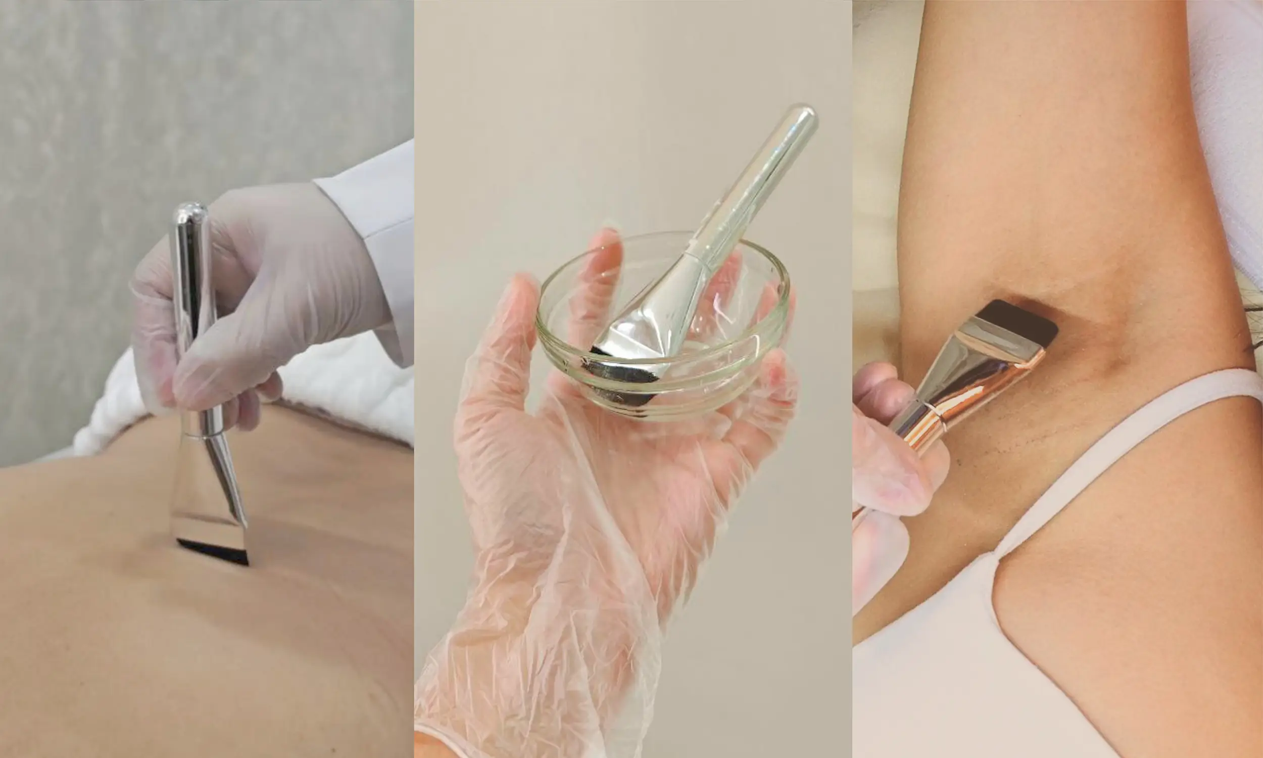 Chemical Peel skin exfoliation acne treatment Skin House