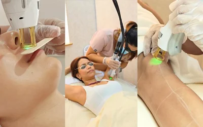GentleMax Pro Plus laser hair removal treatment Skin House