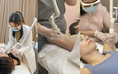 Revlite Laser skin brightening treatment Skin House
