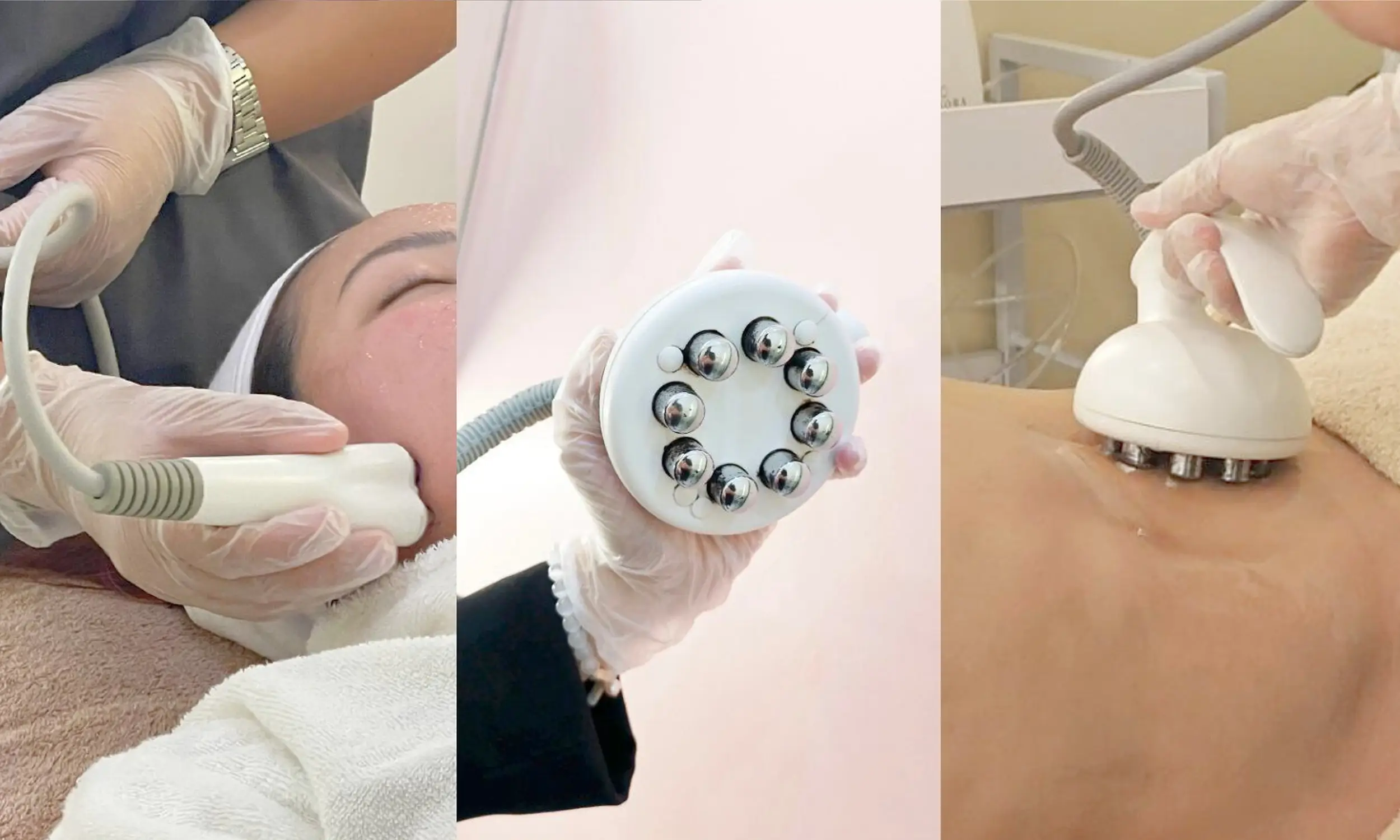 Venus Freeze skin tightening treatment Skin House Clinic